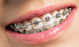 ارتودنسی و ریشه دندان