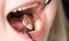 کاهش پوسیدگی دندان