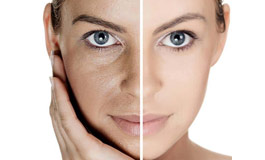 درمان جوانسازی پوست صورت