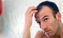 ریزش مو و الگوی طاسی مردانه