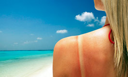 درمان آفتاب‌ سوختگی پوست