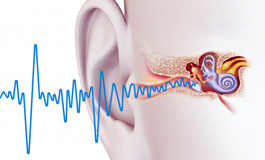 اختلال پردازش شنوایی مرکزی