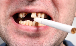 سیگار و خطر برای لثه و دندان