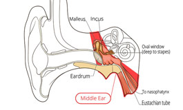 بیماری های گوش میانی