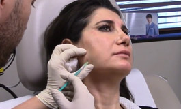 تزریق بوتاکس در ماهیچه های فک