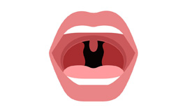 احساس فشردگی در گلو