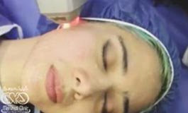 پاکسازی پوست صورت