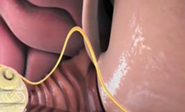 ساختار گوش انسان به زبان ساده