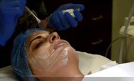 میکرودرم ابریژن و جوانسازی صورت