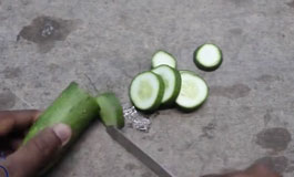 حذف موهای ناخواسته به طور دائم