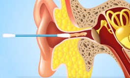 مضررات گوش پاک کن