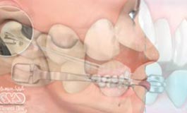ارتودنسی و اصلاح فک و دندان ها