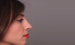 جراحی زیبایی بینی، راینوپلاستی