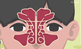 همه چیز در مورد سینوزیت